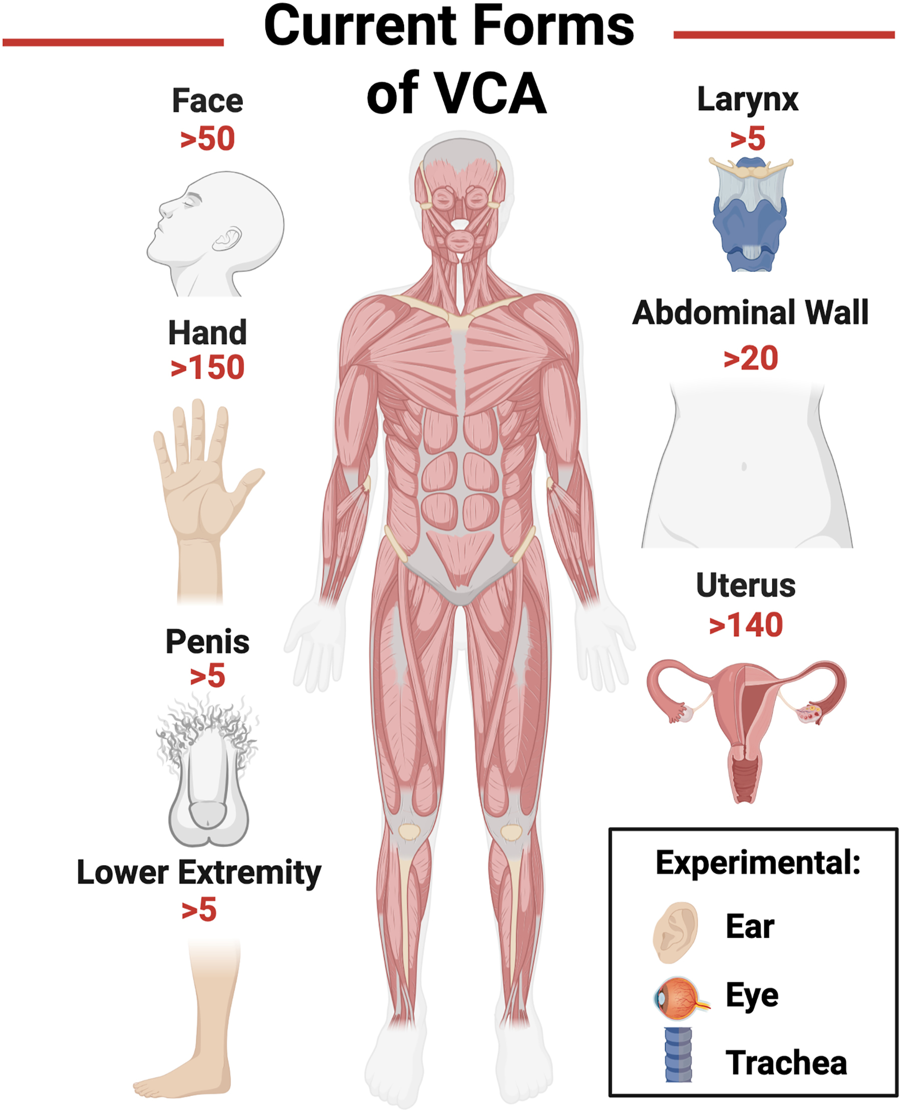 A diagram of the human body highlights current vascularized composite allotransplantation forms, including face, hand, uterus, penis, and limbs.