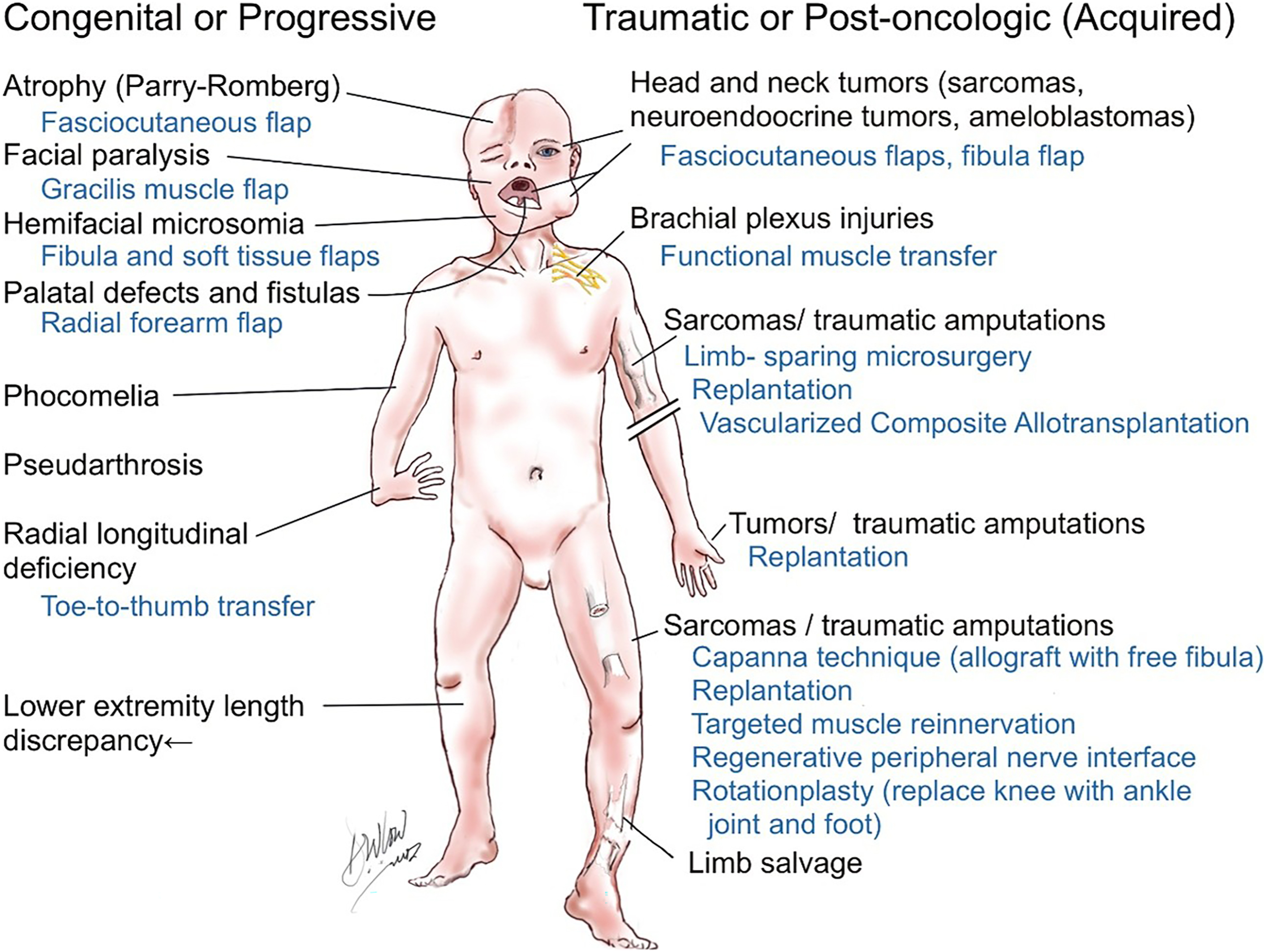 A medical illustration showing surgical reconstruction options for congenital, progressive, traumatic, or post-oncologic conditions.