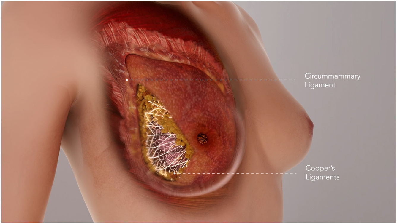 A sectional anatomical view of a breast shows the circummammary ligament and Cooper’s ligaments labeled.