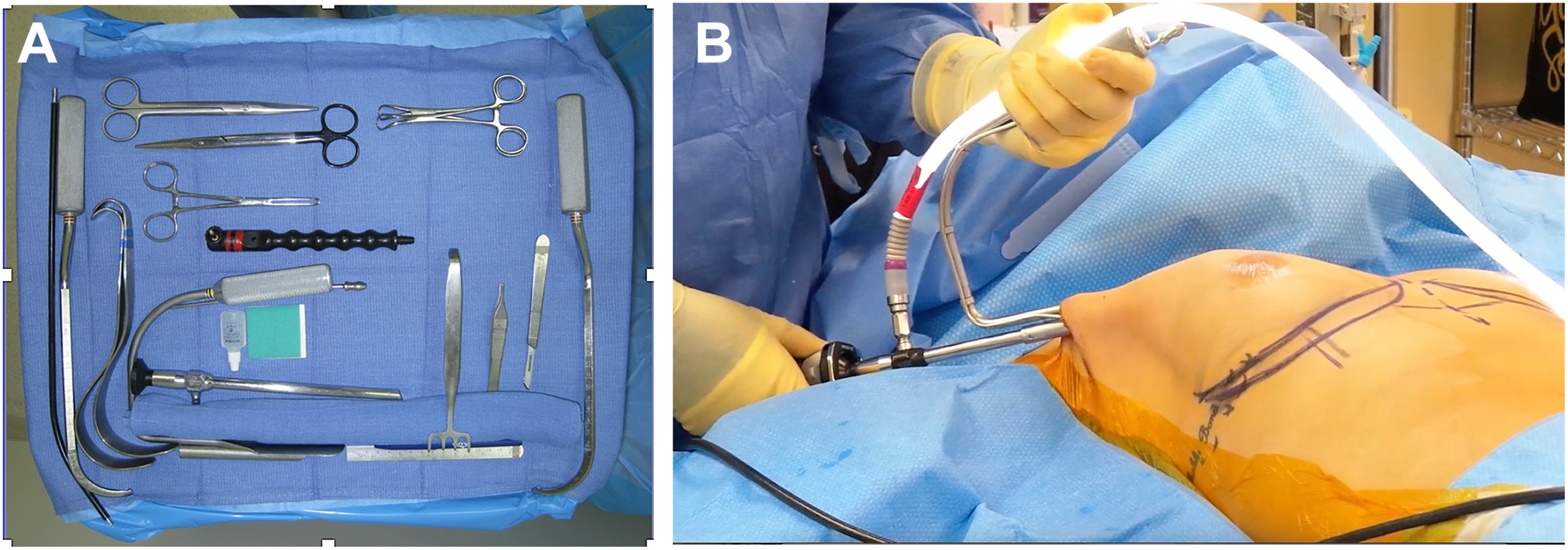 A set of two photographs shows endoscopic instruments laid out on a tray and the endoscopic setup being used on a patient during surgery.