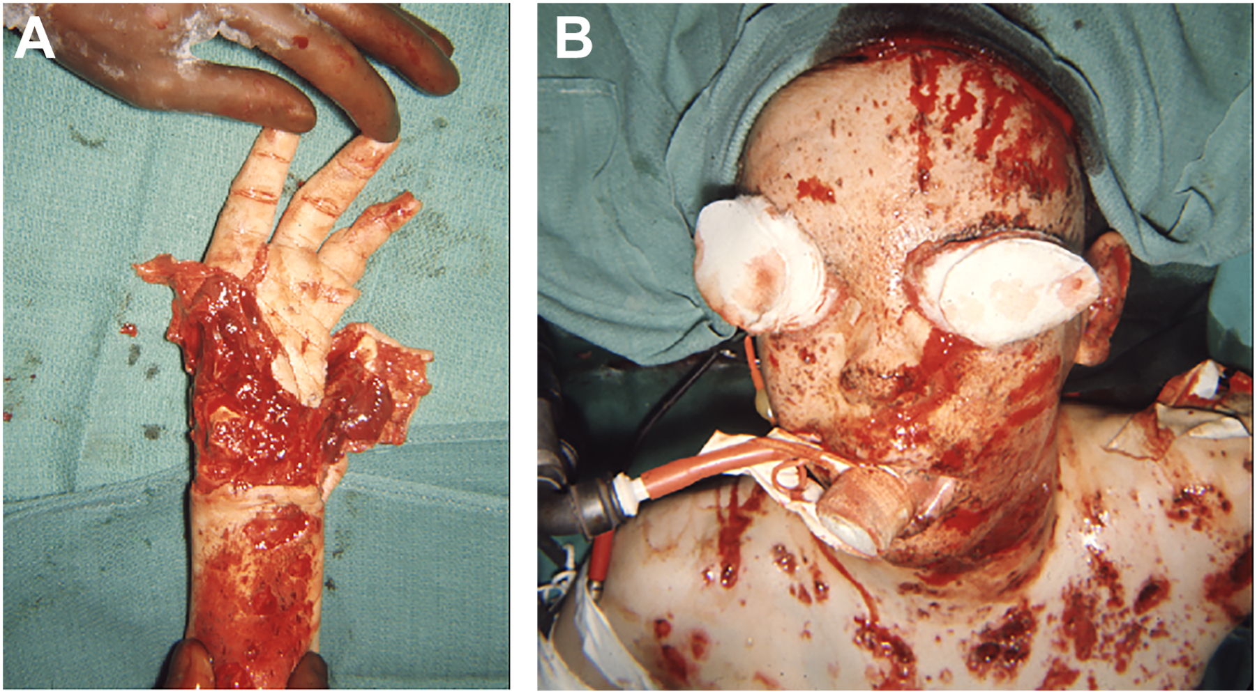 Two clinical photos from a trauma case show a severely injured hand and arm, and the other shows a patient’s face and head with extensive injury and blood.