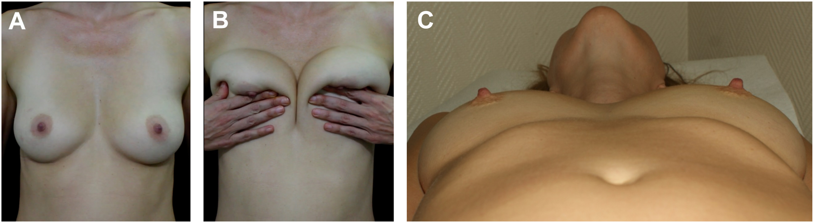 A set of three photographs shows a woman’s chest in front, upward compression, and supine positions.