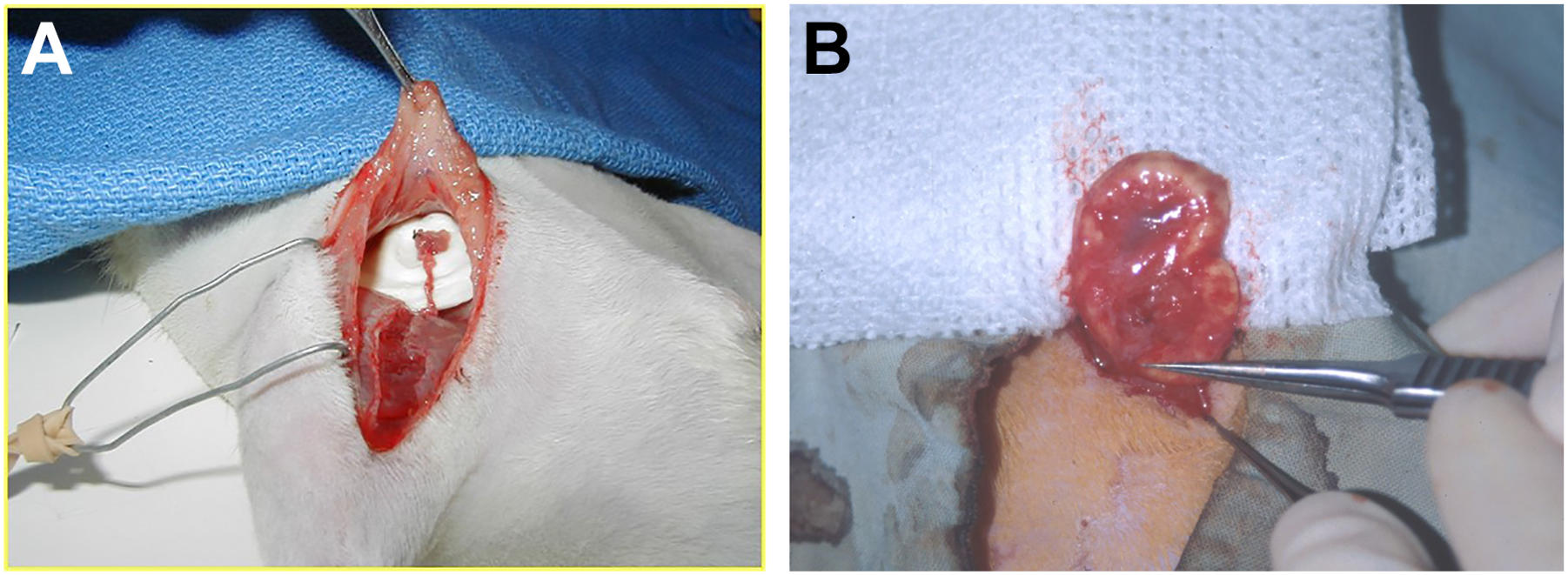 Two surgical images show the creation and harvest of a prefabricated tracheal flap.